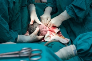Birth by caesarean section - nothing to feel ashamed of. (Image courtesy of arztsamui at FreeDigitalPhotos.net)